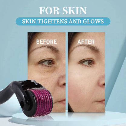 Micro Needling 540 Roller Derma Roller Professional Titanium Dermaroller 0.2/0.25/0.3mm Hair Regrowth Beard Growth Treatment