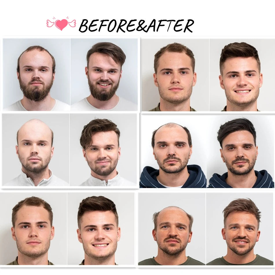 Men Wig Human Hair Toupee Fine Mono Male Wig 130% Density Durable Hair Prosthesis Toupee Men 6" Hair Replacement System For Men