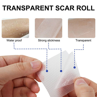 1 Roll Invisible Silicone Scar Sheets , 4cm X 150/300cm Self-Adhesive Scar Cover Tape Reusable and Effective Skin Care Strips