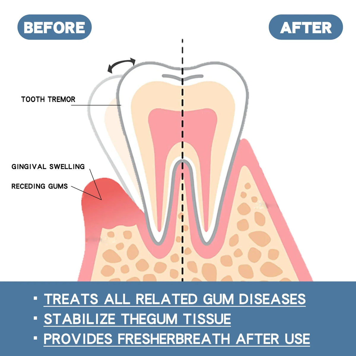 Focus on gum repair, relieve tooth pain, clean and whiten toothpaste