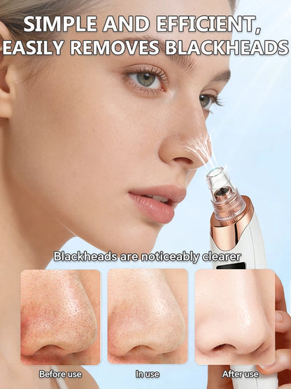 Electric Pore Vacuum Blackhead Remover for Removing Blackheads, Professional Facial Skin Pore Extractor Suction Machine