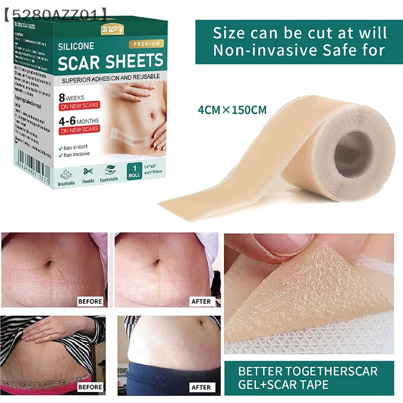1 Roll Silicone Scar Sheets Gel Scar Patch 4cmX150cm Self-Adhesive Scar Cover Tape Reusable And Effective Skin Care Strips