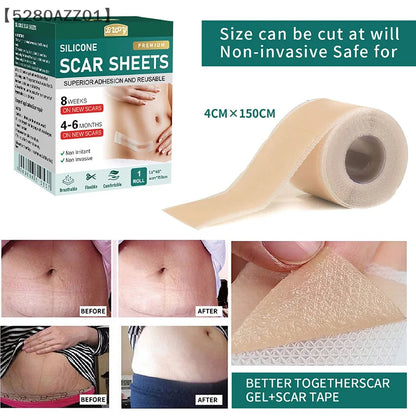 1 Roll Silicone Scar Sheets Gel Scar Patch 4cmX150cm Self-Adhesive Scar Cover Tape Reusable And Effective Skin Care Strips