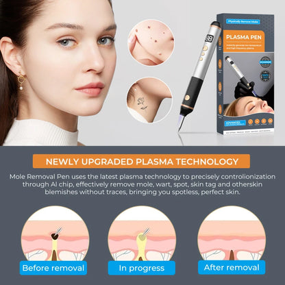 Face Beauty Tools Portable 15-Level Painless Plasma Pen for Skin Wart Mole Removal Electrocautery Device Face Skin Eraser Tools