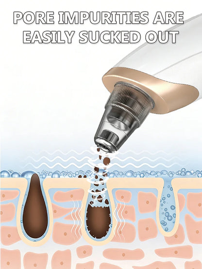 Electric Pore Vacuum Blackhead Remover for Removing Blackheads, Professional Facial Skin Pore Extractor Suction Machine
