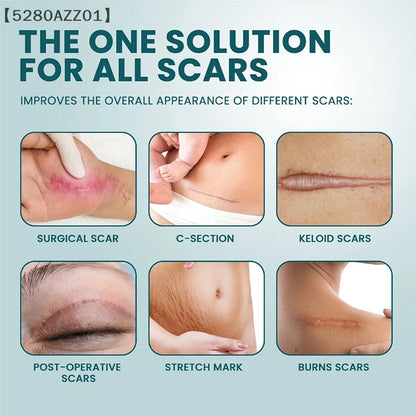 1 Roll Silicone Scar Sheets Gel Scar Patch 4cmX150cm Self-Adhesive Scar Cover Tape Reusable And Effective Skin Care Strips