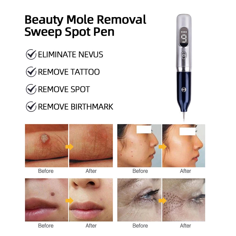Laser Plasma Pen For Mole Dark Spot Freckle Nevus Wart Skin Tag Pimples Tattoo Removal Skin Face Care Beauty Machine Papilloma