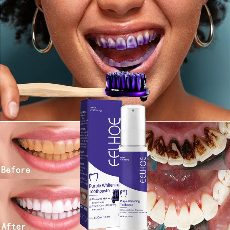 1pcs Teeth Cleansing Whitening Toothpaste Whiten Gel Whitener Bleach Removes Stains Fresh Breath Tooth Cleaning Korea Products