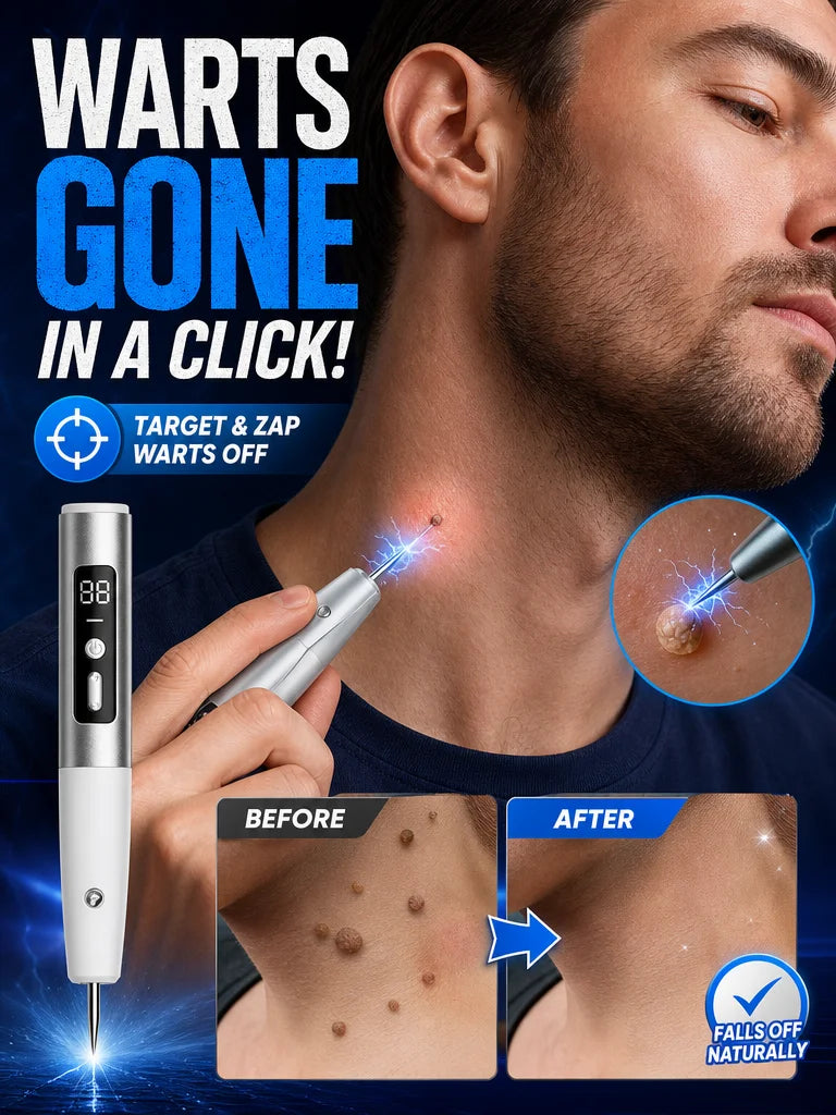 Mole Removal Machine Wart Removal Pen,Plasma,For Mole Removal Machine Flat Wart Skin Tag Tool Free Shipping Professional
