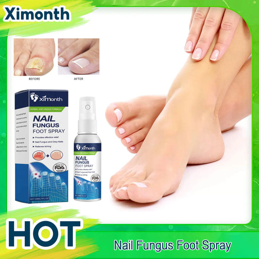 Foot Odor Removal Spray Deodorant Improve Onychomycosis Inhibit Nail Fungus Antiperspirant Refresh Shoe Sock Antibacterial Spray