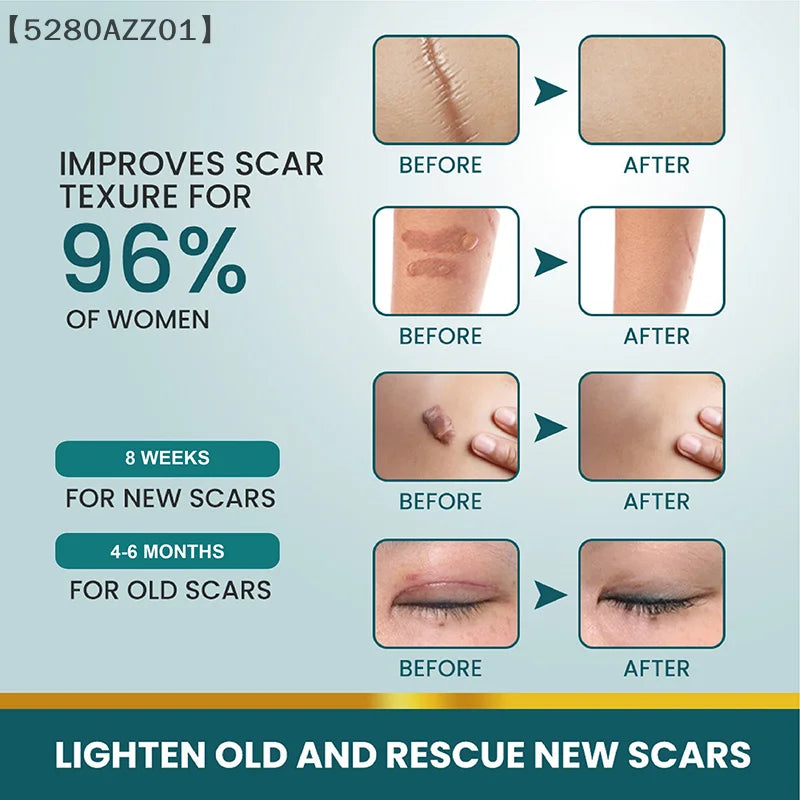 1 Roll Silicone Scar Sheets Gel Scar Patch 4cmX150cm Self-Adhesive Scar Cover Tape Reusable And Effective Skin Care Strips