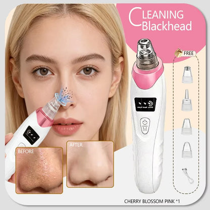 Electric Pore Vacuum Blackhead Remover for Removing Blackheads, Professional Facial Skin Pore Extractor Suction Machine