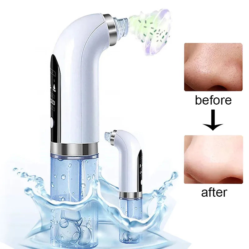 Water Dermabrasion Hydra Peeling Aqua Facial Clean Beauty Machine Small Bubble Electric Blackhead Remover Vacuum Cleaner