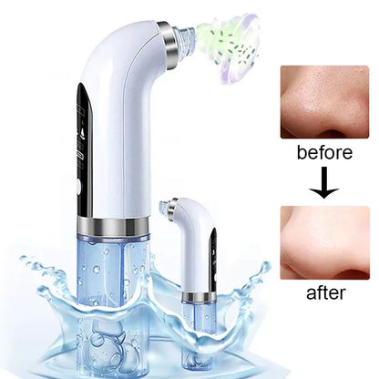 Water Dermabrasion Hydra Peeling Aqua Facial Clean Beauty Machine Small Bubble Electric Blackhead Remover Vacuum Cleaner