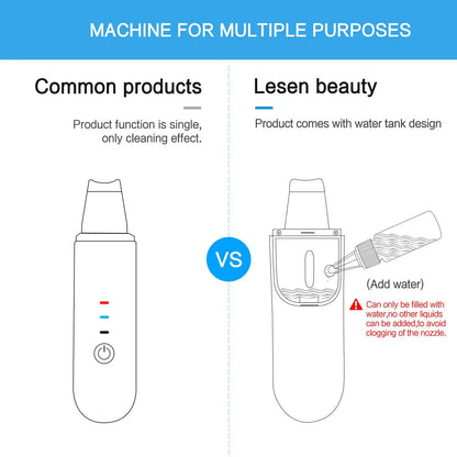 EMS Machine Ultrasonic Skin Scrubber Vibration Face Spatula Blackhead Remover Shovel Clean Cavitation Peeling Facial Lifting