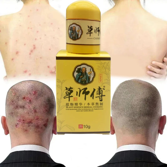 10g Caoshifu Eczema Psoriasis Ointment Pruritus Antibacterial Dermatitis Herbal Cream Eczematoid Anti-itching Foot Care