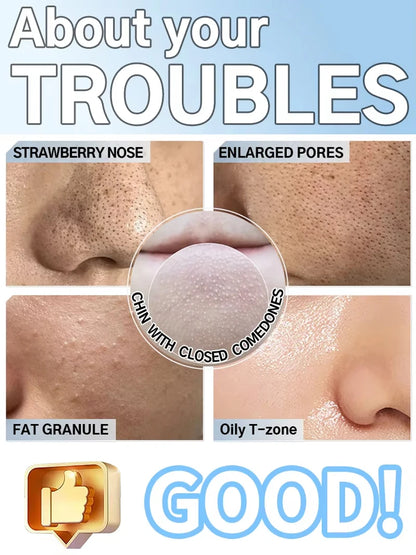 Electric Pore Vacuum Blackhead Remover for Removing Blackheads, Professional Facial Skin Pore Extractor Suction Machine