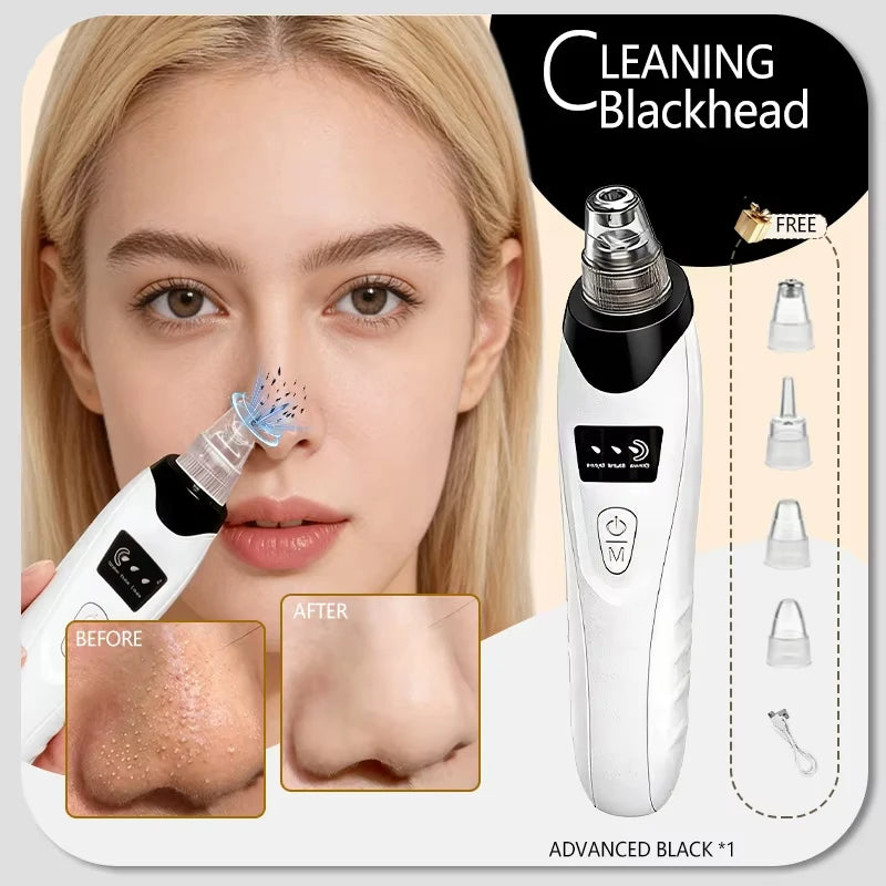 Electric Pore Vacuum Blackhead Remover for Removing Blackheads, Professional Facial Skin Pore Extractor Suction Machine