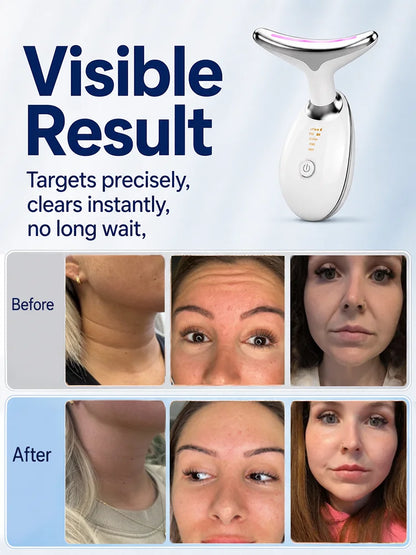 Face And Neck Wrinkle Remover Face And Neck Lifting Machine Neck Beauty Device Skin Tightening Machine