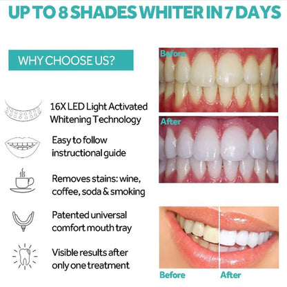Teeth Blue Light Whitening Instrument Universal Interface Portable Rechargeable Blue Light Oral Care Lamp Tool