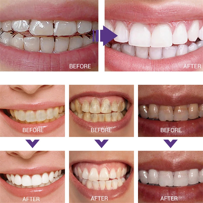 1pcs Teeth Cleansing Whitening Toothpaste Whiten Gel Whitener Bleach Removes Stains Fresh Breath Tooth Cleaning Korea Products
