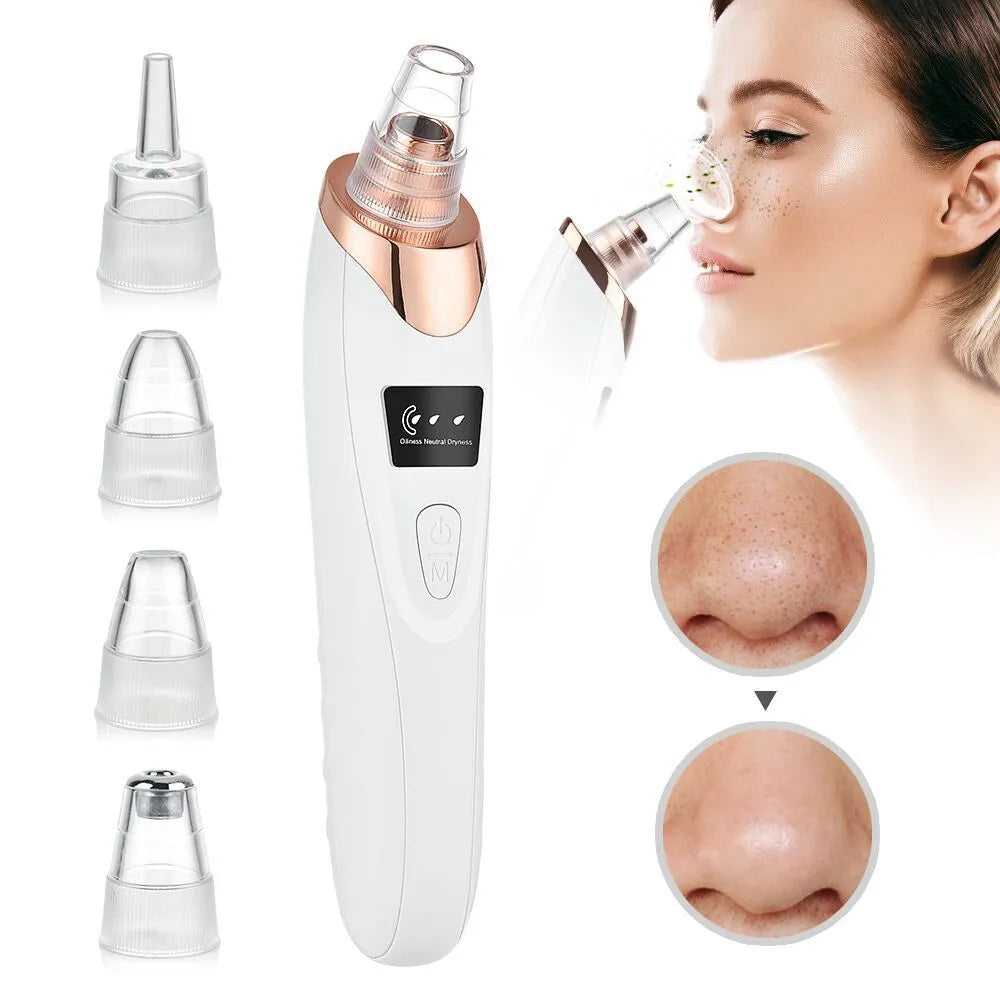 Electric Blackhead Remover beauty personal skin care