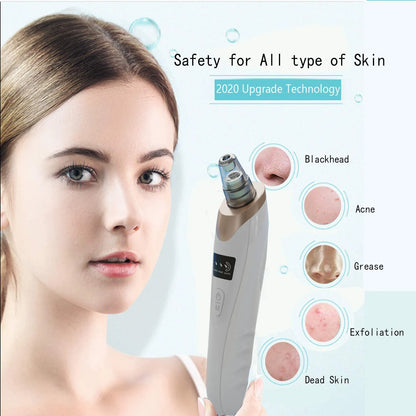 Electric Blackhead Remover beauty personal skin care